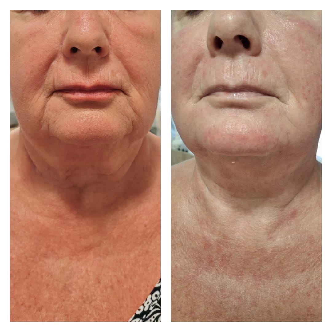 Baby Face Effect - obrazek 5
