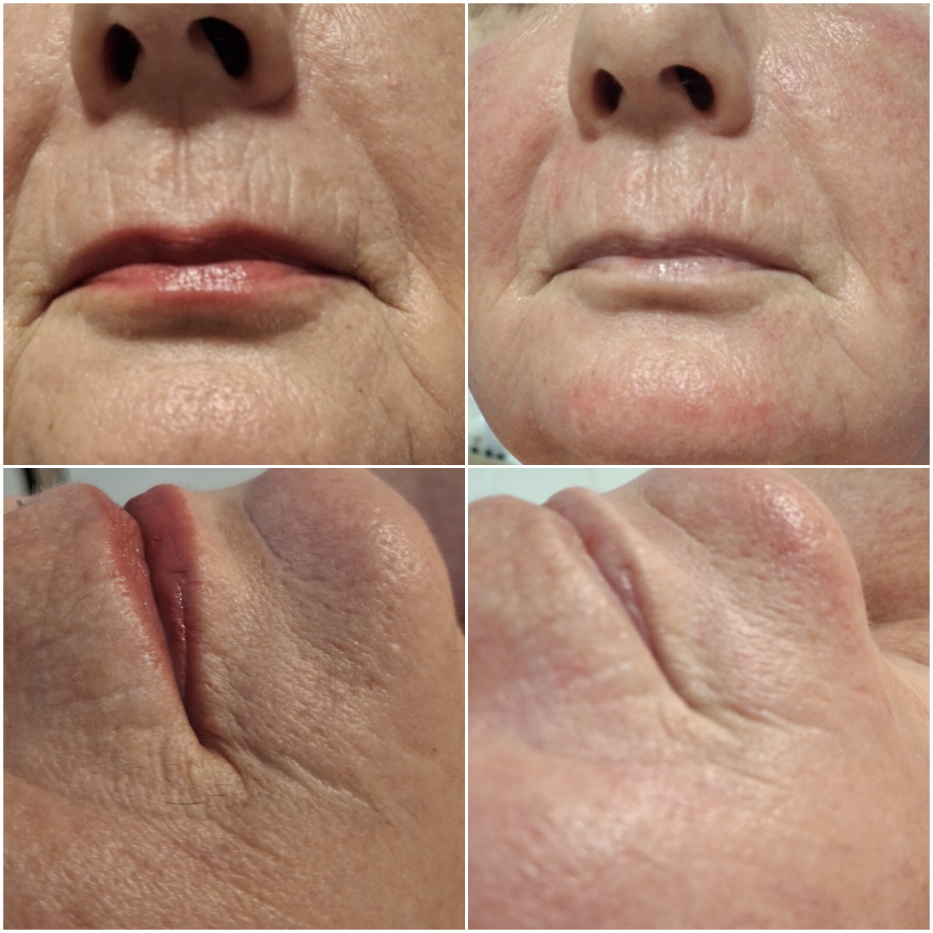 Baby Face Effect - obrazek 2