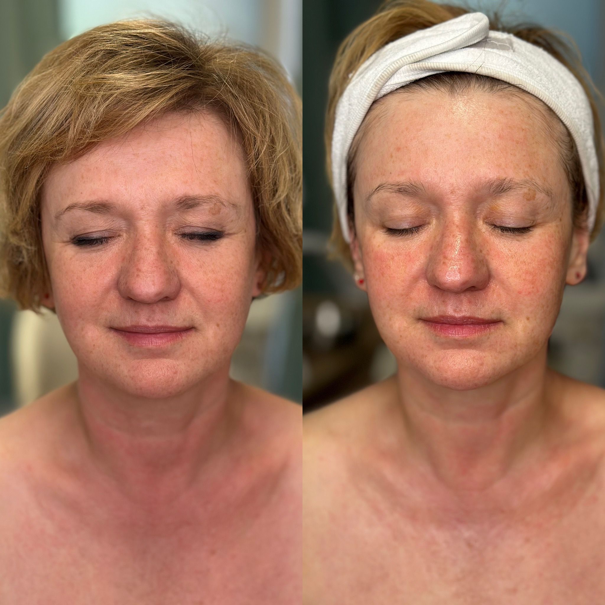 Baby Face Effect - obrazek 3