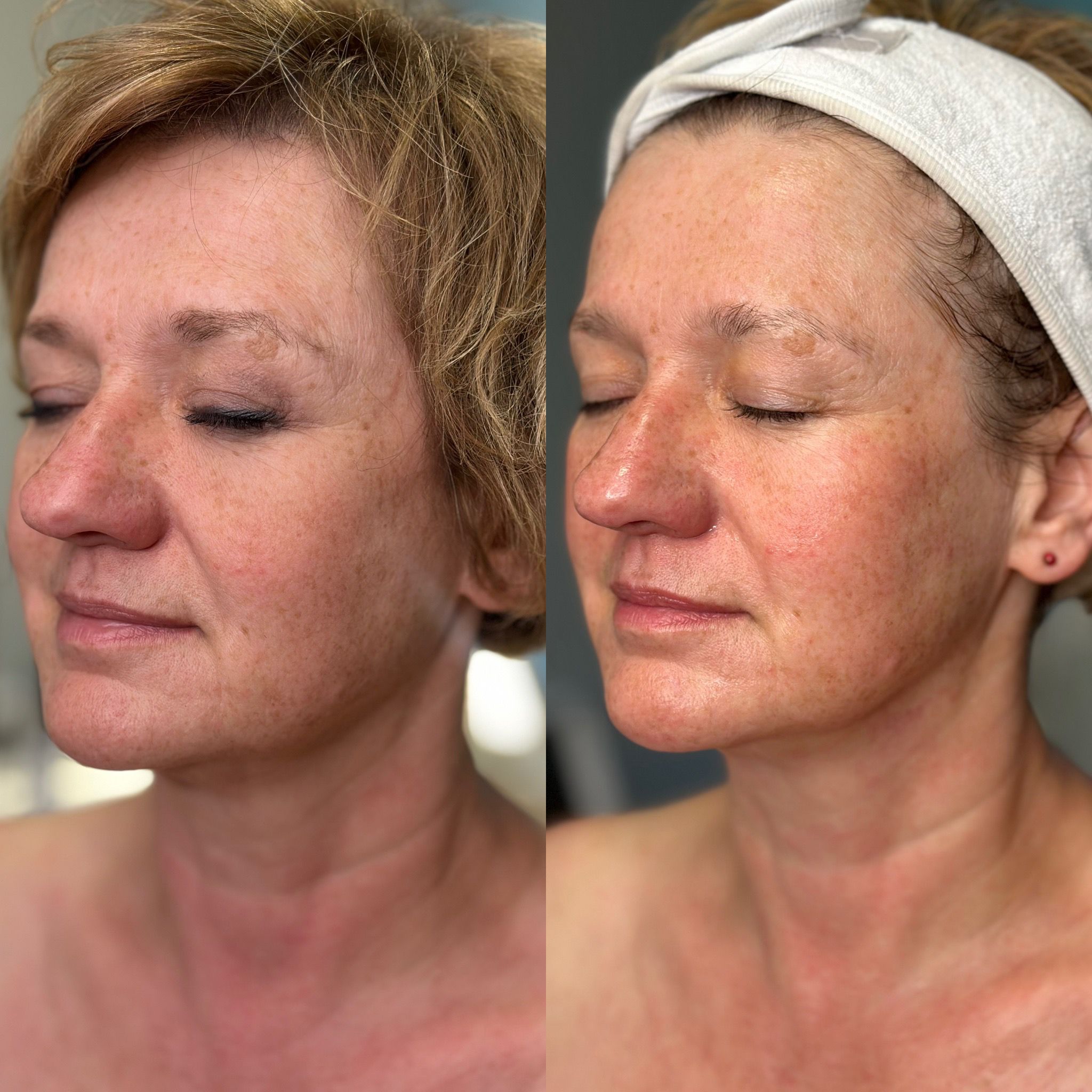 Baby Face Effect - obrazek 4
