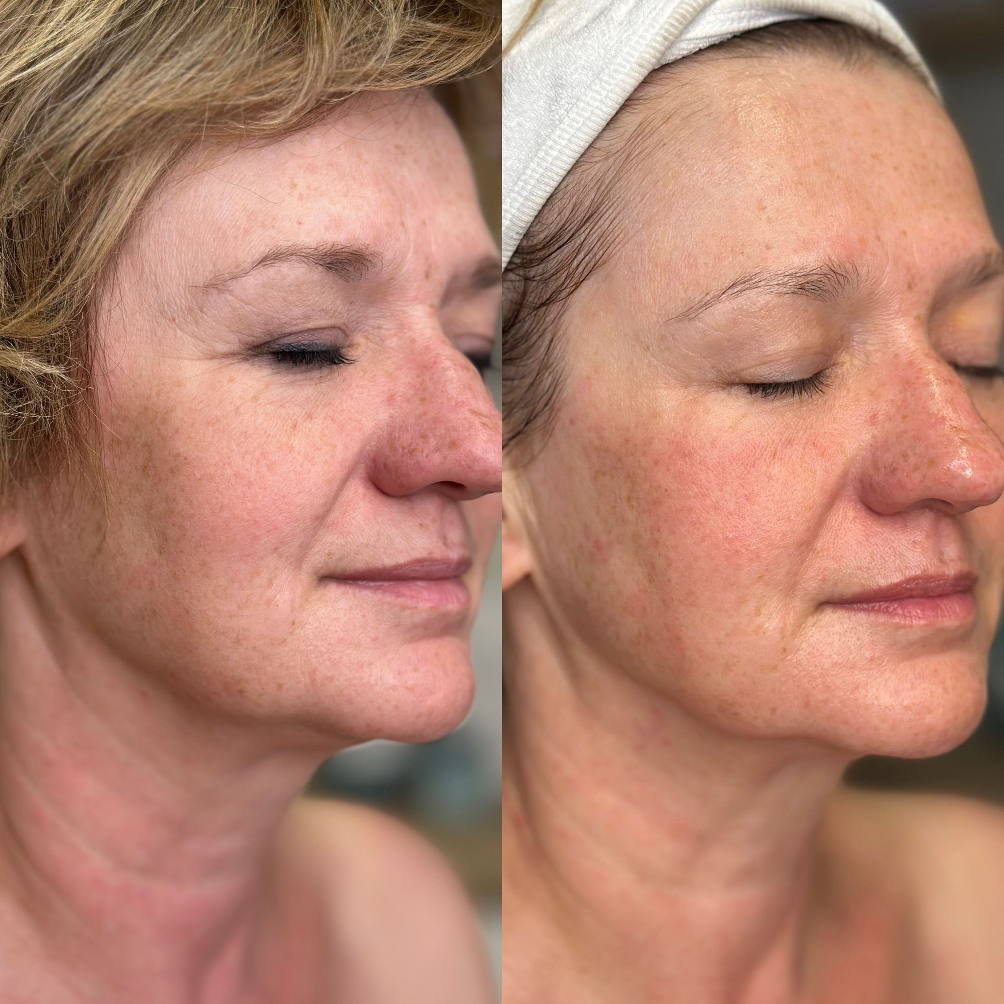Baby Face Effect - obrazek 6